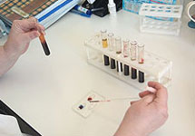 Анализ крови. Фото с сайта hospital.chukotnet.ru