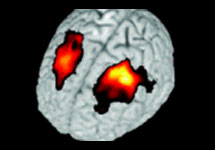 Сканирование мозга. Изображение с сайта www.livescience.com